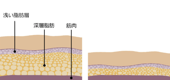 脂肪層のイラスト